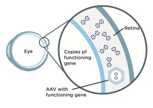 Gene Therapy-2